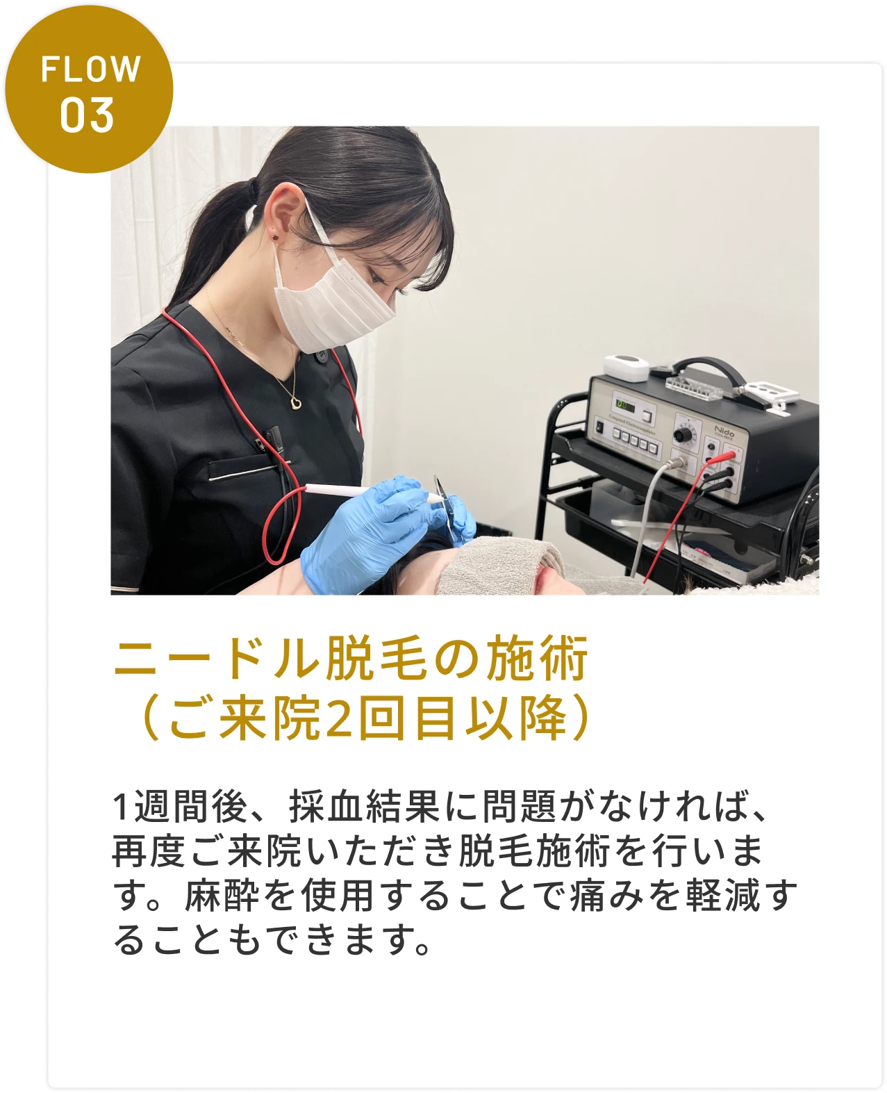 ニードル脱毛の施術（ご来院2回目以降）