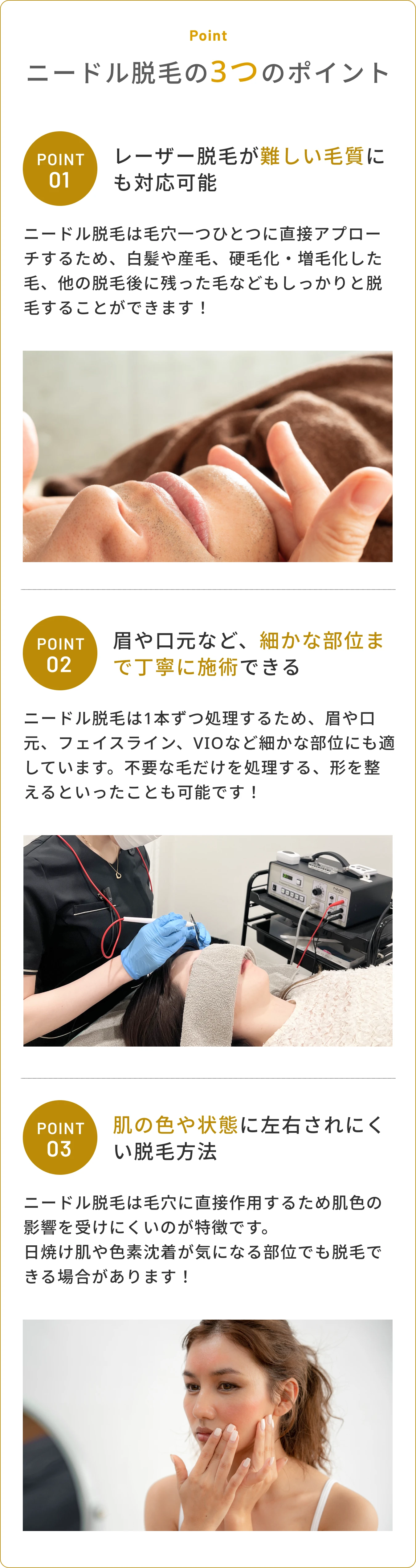 ニードル脱毛の特徴とメリット