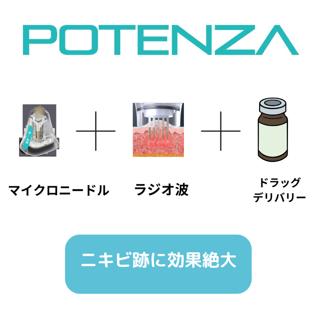 ポテンツァのトリプル効果