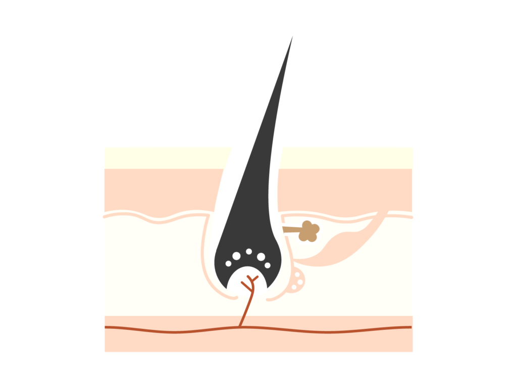 残り毛・硬毛化のイメージ写真