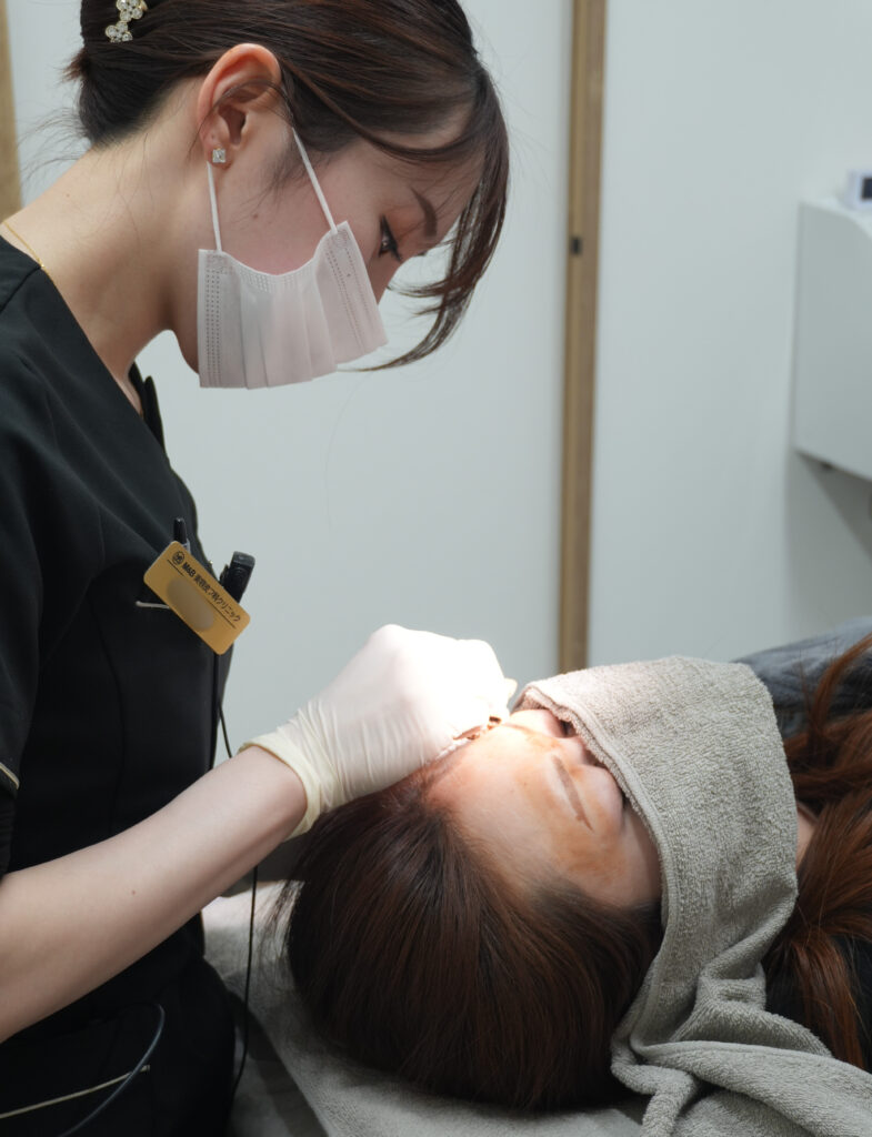 施術のイメージ写真